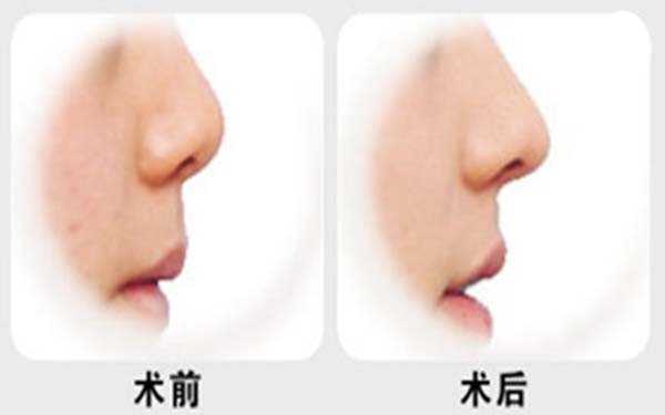 杭州專業(yè)整形美容醫(yī)院推薦榜單TOP7！熱門前三家療效不凡~