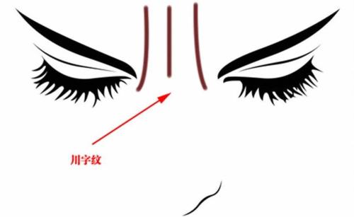 成都雙眼皮修復(fù)手術(shù)：五家性價比高、技術(shù)好的醫(yī)院推薦