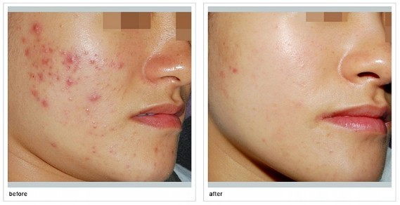 煙臺市牙齒種植最佳醫(yī)院匯總：哪家醫(yī)院值得選擇？一文速覽享知！