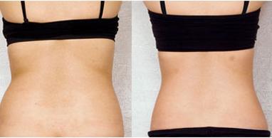 湖州湖人眼袋醫(yī)院TOP5，曙光與唯美齊爭魁！