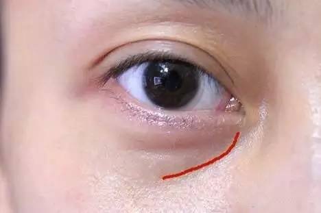 沈陽哪家醫(yī)院做雙眼皮好？推薦這幾家，讓你的雙眼美麗動人起來！