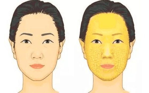 滄州治療疤痕的正規(guī)醫(yī)院推薦：專業(yè)科技祛疤，效果顯著！點擊了解！