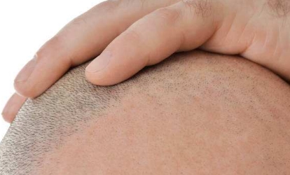 深圳最熱門的拉皮手術(shù)醫(yī)生推薦！值得信賴的十大醫(yī)師名單發(fā)布！