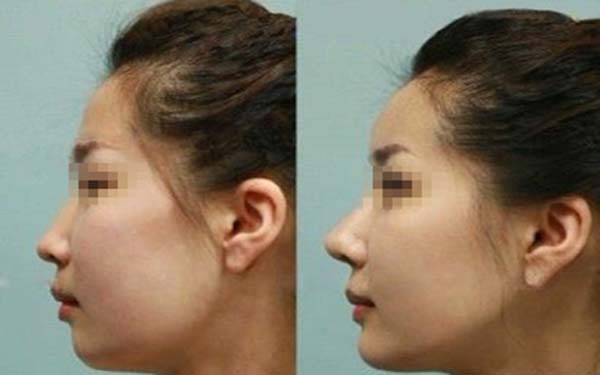 深圳頂級整容醫(yī)院排行榜發(fā)布！整形美容醫(yī)院報價明細表最新更新