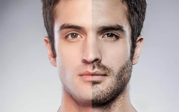 河南整形醫(yī)院的最佳選擇，讓您告別煩惱的去皮脂腺痣解決方案！六大推薦醫(yī)院匯總