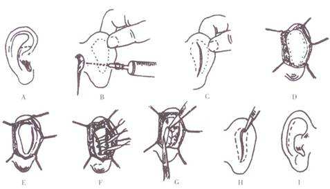 深圳眼部整形業(yè)內(nèi)杰出醫(yī)生盤點(diǎn)！錯過可惜，快來查看！