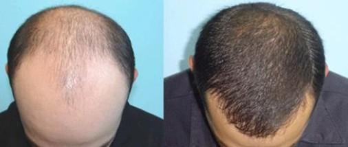 深圳哪家公立整形醫(yī)院好？本地人廣受推崇的前六名推薦