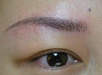 榆林市雙眼皮良心推薦！權(quán)威醫(yī)美機(jī)構(gòu)幫你找對(duì)方法