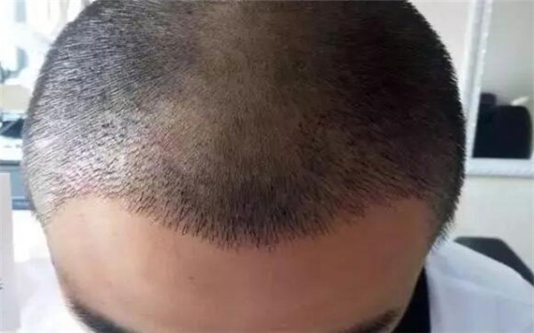 湛江整形醫(yī)院排名前十，華美、博愛、美聯(lián)致美等入選！詳細(xì)介紹醫(yī)院背景及特色！