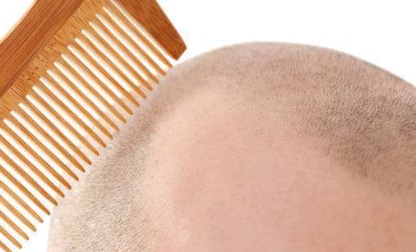 滄州市哪家醫(yī)院的隆鼻整形技術最實力？排行榜公布！