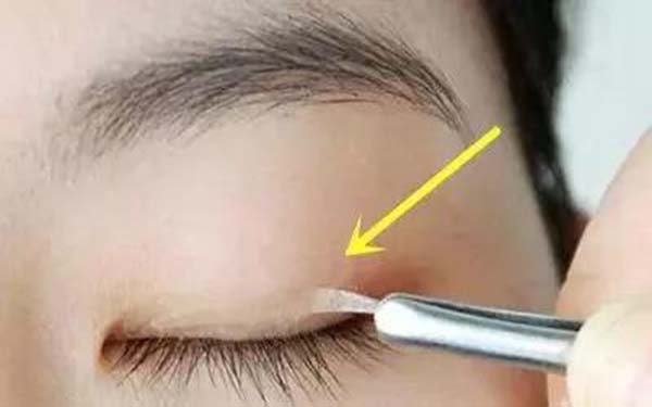 汕頭植發(fā)醫(yī)院排行榜前六：雍禾稱霸！曙光、華美也上榜！快來了解一下吧