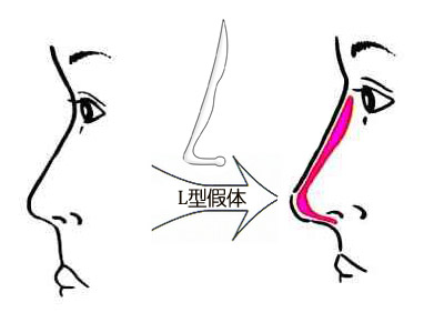 深圳最佳激光脫毛整形醫(yī)院推薦-公立醫(yī)院領(lǐng)跑市場(chǎng)！