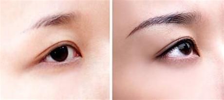 漳州哪里可以找到專業(yè)的激光祛斑中心，保障您的整形效果！