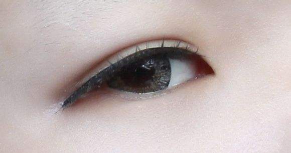 沈陽玻尿酸去皺中心：2023新評(píng)選揭曉！這幾間去頸紋醫(yī)院值得考慮嗎？快來查看一下！