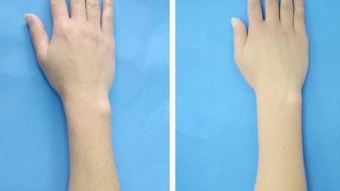 泰安斑點(diǎn)治療醫(yī)院排行榜：選擇這些醫(yī)院，讓斑點(diǎn)不再遮擋你的美麗~