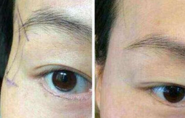 江蘇區(qū)整容醫(yī)院推薦：想在江蘇改頭換面的友人來(lái)看看這篇！高質(zhì)量美容機(jī)構(gòu)盤點(diǎn)提供參考