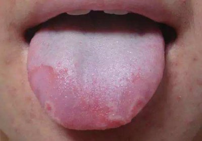 懷化瘦腿抽脂手術(shù)醫(yī)生