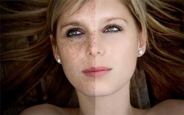 河北雙眼皮調理醫(yī)生