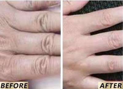 西安哪家整形醫(yī)院綜合實力強，口碑好！米蘭柏羽榜首完勝！