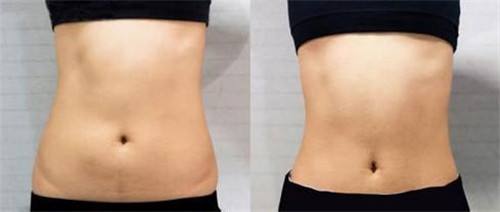 福州隆鼻整形醫(yī)生推薦匯總：專(zhuān)家升級(jí)，暢談口碑與擅長(zhǎng)！