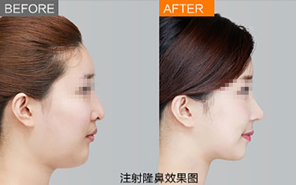 鄭州唇部整形醫(yī)院推薦：如何選擇合適的醫(yī)院？友友必看！