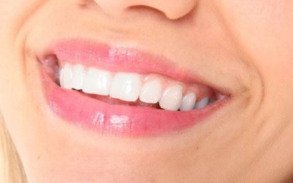 西藏雙眼皮手術(shù)挑選指南，暢享自然美麗眼瞳