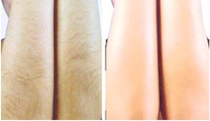 解放眼袋重害！揭秘成都頂尖醫(yī)療機構(gòu)眼袋技術(shù)