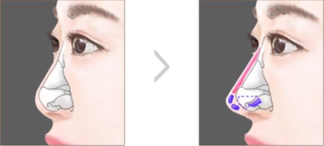 西安整形美容醫(yī)院推薦top4大揭秘！從西美到時光，最佳選擇一覽無余！