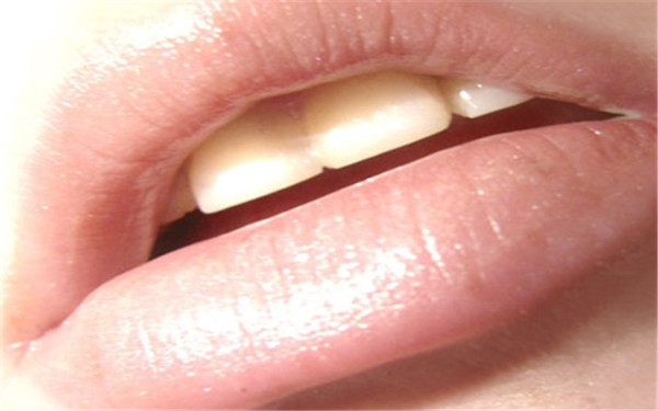 長沙霧化填充川字紋醫(yī)生