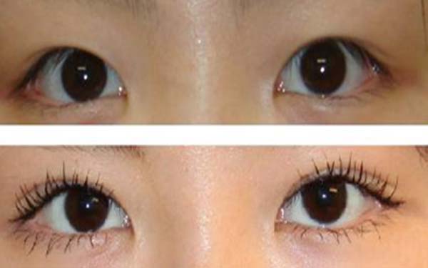 衡陽五家頂尖激光祛斑整形醫(yī)院匯總！療效質(zhì)優(yōu)，廣受好評！