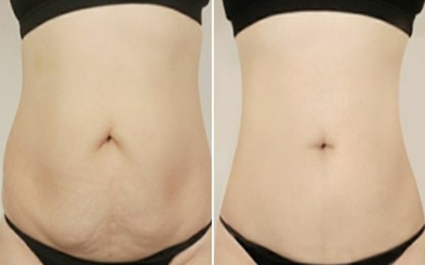 盤點(diǎn)溫州十佳隆鼻醫(yī)生，暢談鼻部整形專家與收費(fèi)標(biāo)準(zhǔn)！