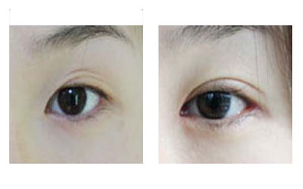 熱瑪吉整形醫(yī)院最受好評(píng)的六個(gè)機(jī)構(gòu)合集！尋找這些隱藏的寶藏醫(yī)院，分享給你，讓你重拾自信！