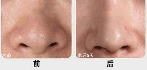 廈門市有哪些醫(yī)院提供優(yōu)質(zhì)的脂肪填充服務(wù)？江頭醫(yī)院、臉康整形醫(yī)院、美麗醫(yī)療中心等值得一看！快來了解一下