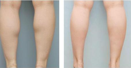 金華整形醫(yī)院綜合排名出爐：芘麗芙躋身榜眼，瑞麗奪得冠軍