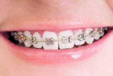 重慶激光洗紋身整形醫(yī)院聚焦盛夏排行榜，單品強(qiáng)力推薦！