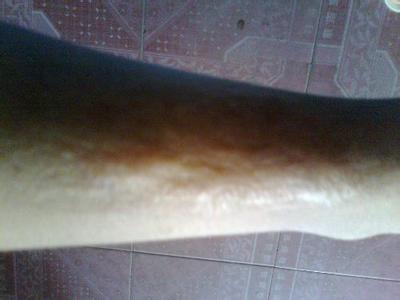 紹興耳軟骨隆鼻手術醫(yī)生