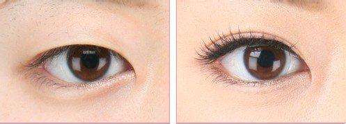 鄭州特色牙齒種植醫(yī)院排行榜：這些機(jī)構(gòu)守護(hù)你的口腔健康