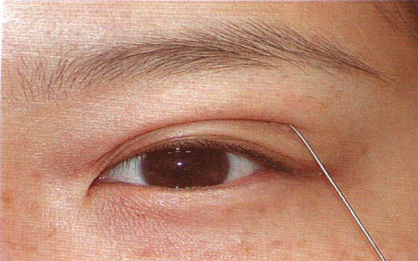 長沙五家醫(yī)院哪家提供優(yōu)質吸脂技術？推薦專業(yè)減重能手！