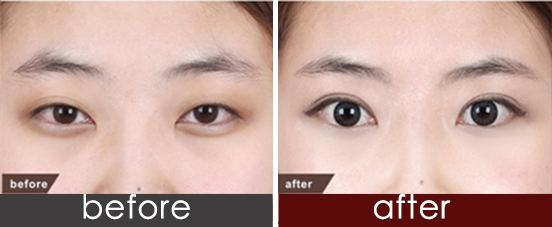 張家口川字紋提拉醫(yī)生