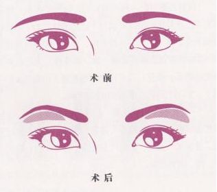 魅力煥發(fā)！常德市多家信譽(yù)醫(yī)院助你邁過疤痕困擾