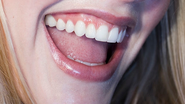 鄭州雙眼皮全切醫(yī)生