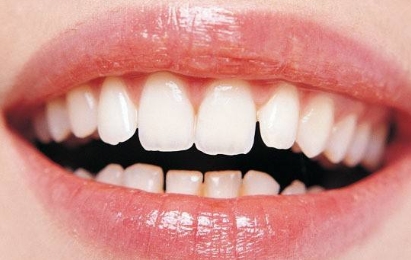 2023年，哪家醫(yī)院在武漢提供高質(zhì)量的無(wú)痕隆胸手術(shù)？