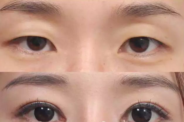 恩施脂肪整形豐胸醫(yī)生