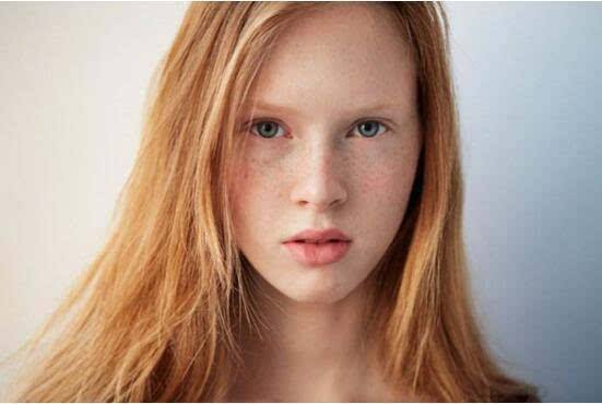 深圳微晶無(wú)創(chuàng)溶斑醫(yī)生