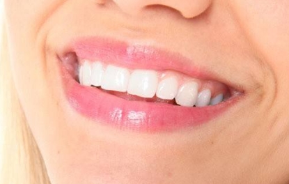 2023年廣州哪家醫(yī)院的額頭注射除皺技術(shù)最出色？公立私立排名top10強！