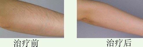 連云港哪些整形美容醫(yī)院在2023年在玻尿酸頸紋填充方面有口碑？十大排名新鮮出爐！