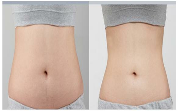 2023年貴陽哪家雙眼皮整形醫(yī)院口碑，排名前10強整容美容醫(yī)院全揭秘