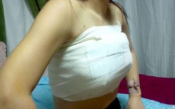 鄭州哪家整形醫(yī)院能讓您擁有完美豐唇？2023年排名前十的鄭州豐唇整形醫(yī)院是哪些？