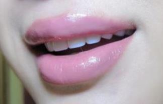 無(wú)錫嗨體祛眼周細(xì)紋醫(yī)生