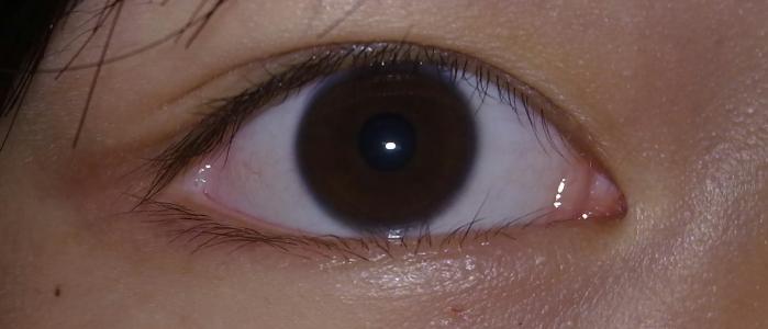 2023年浙江哪些醫(yī)院是值得去的提拉去眉間紋醫(yī)療美容醫(yī)院排名榜前十強(qiáng)詳解，實力解析！